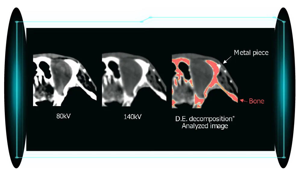 Cardiac CT image 6
