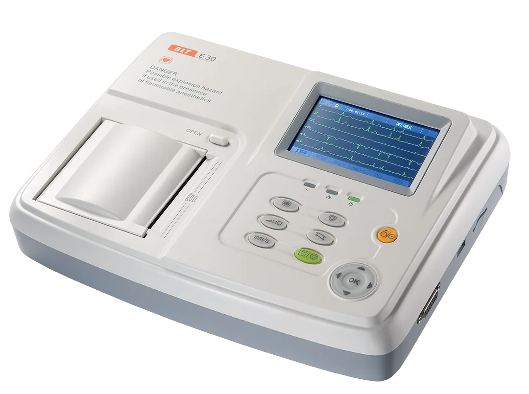 ECG image 3