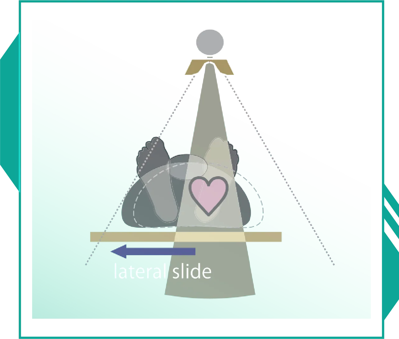 Cardiac CT image 8