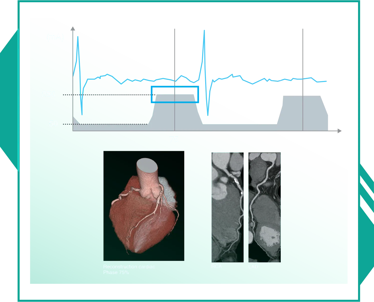 Cardiac CT image 9
