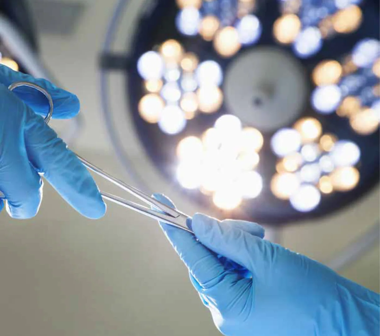 Laparoscopy image 3