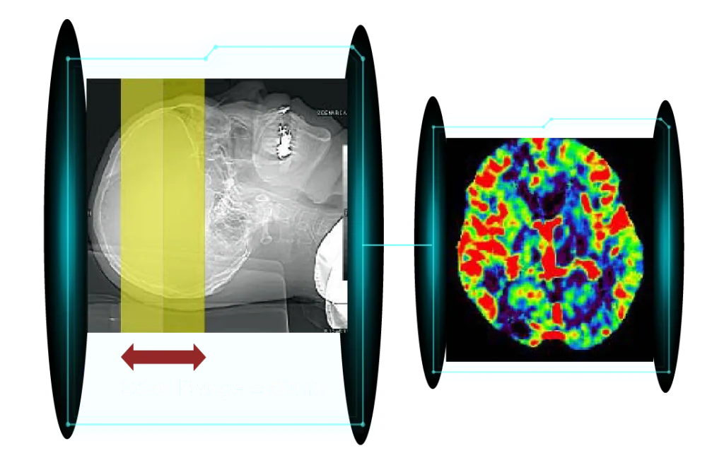 Cardiac CT image 4